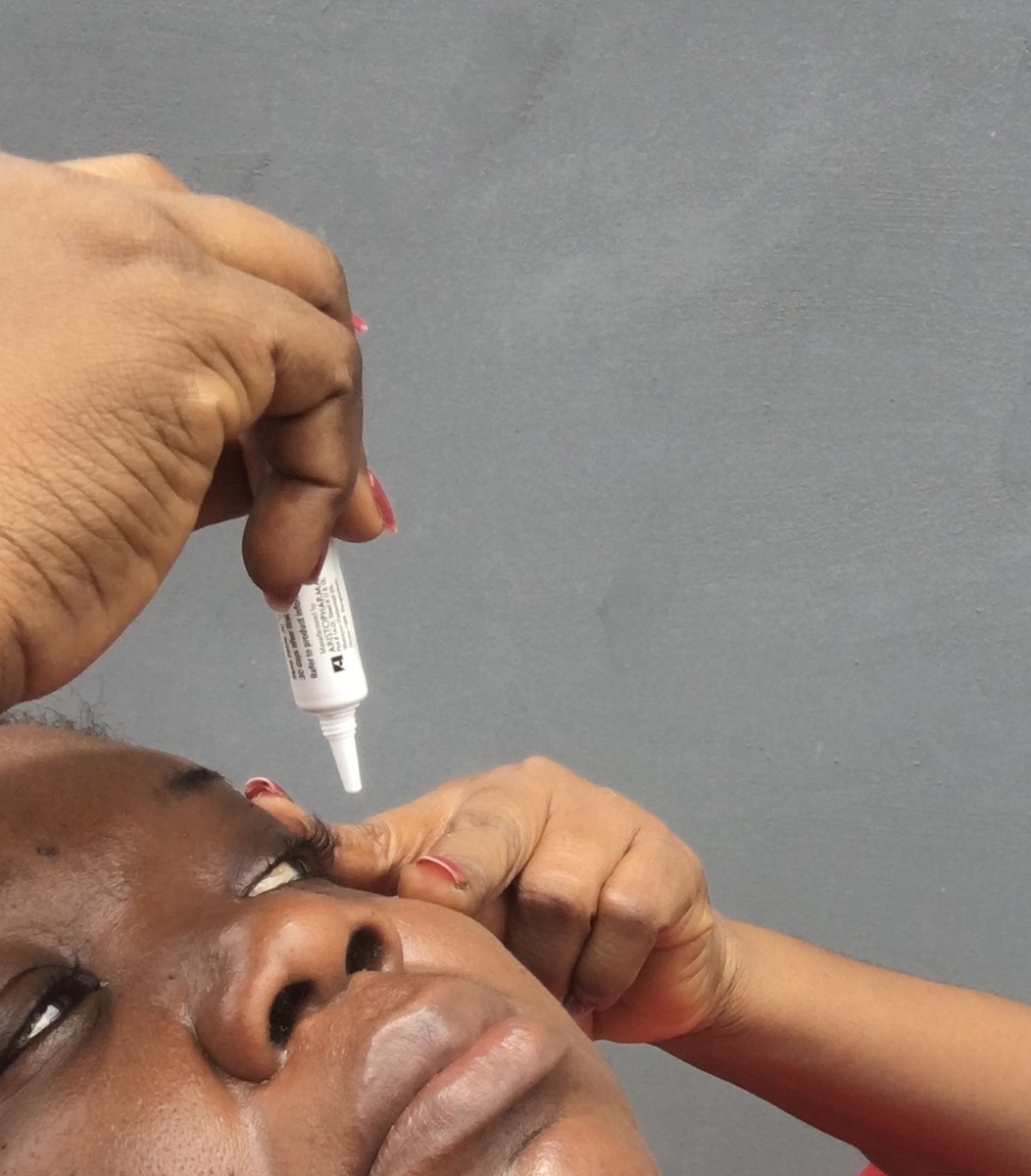 Close-up of a person putting in eye drops
